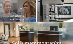 Solis mammography 