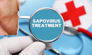 Sapovirus