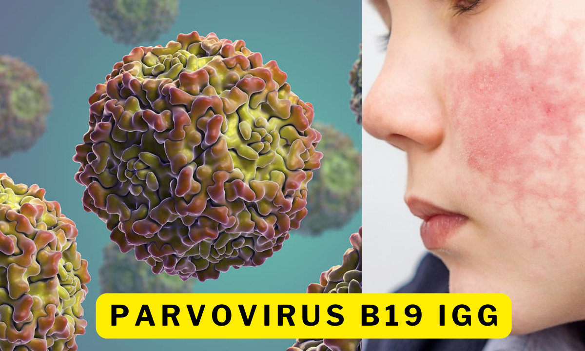 parvovirus b19 igg