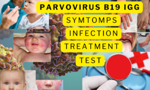 parvovirus b19 igg