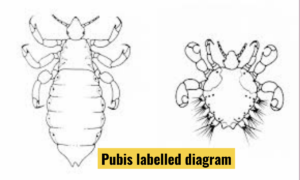  phthirus pubis 