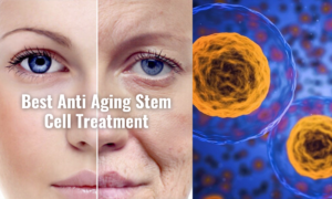 cell aging