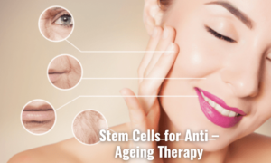 cell aging