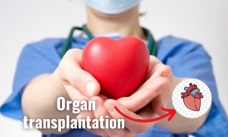 organ transplantation