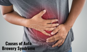 auto brewery syndrome