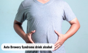 auto brewery syndrome