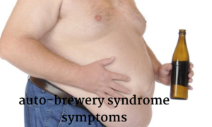 auto brewery syndrome