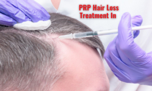 prp for hair growth