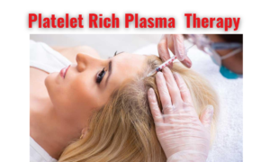 prp for hair growth