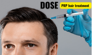 prp for hair growth