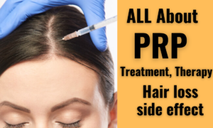 prp for hair growth