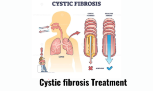 cystic fibrosis supportive therapy