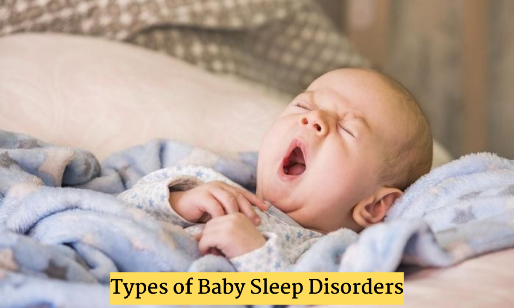 Baby Sleep Disorder