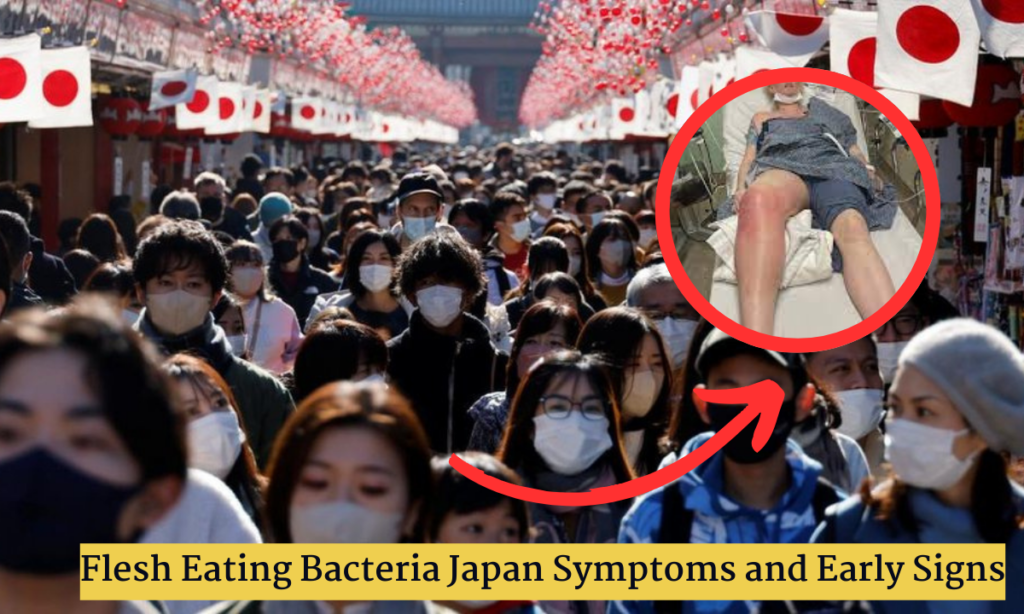 Flesh Eating Bacteria Japan